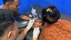 ANAK 3 TAHUN DISERANG DAN DIGIGIT ANJING DIDUGA RABIES DI MANGGELEWA, POLISI IMBAU WARGA WASPADA